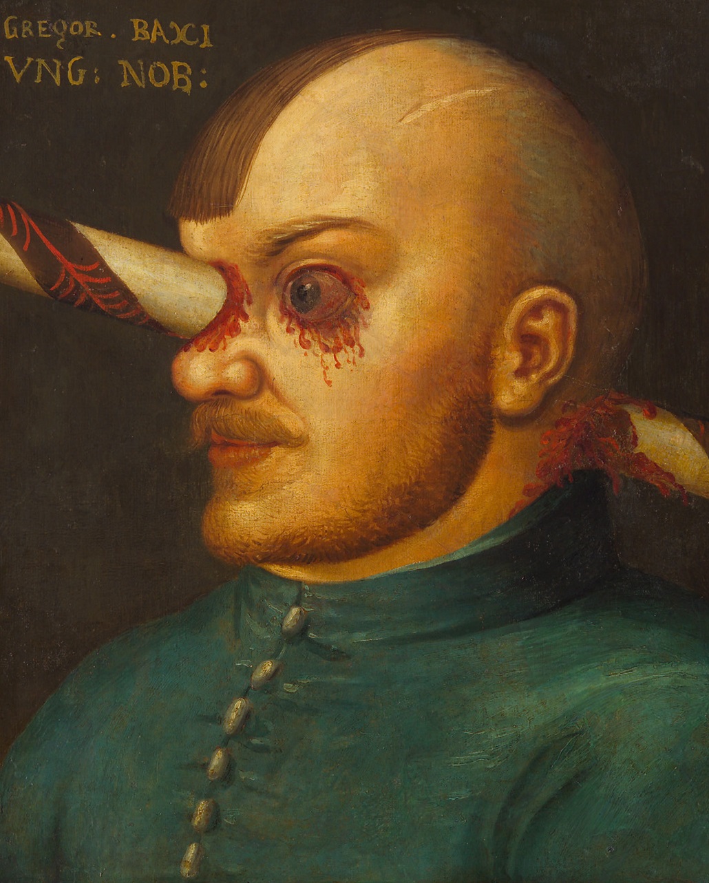 Das Bildnis eines Schwerverletzten: Gregor Baci, Deutsch, 2. Hälfte 16. Jahrhundert, Öl auf Leinwand, Schloss Ambras Innsbruck, Kunst- und Wunderkammer, Inv.-Nr. GG 7978. Foto: KHM-Museumsverband, Wien. Das Bildnis eines Schwerverletzten: Gregor Baci, Deutsch, 2. Hälfte 16. Jahrhundert, Öl auf Leinwand, Schloss Ambras Innsbruck, Kunst- und Wunderkammer, Inv.-Nr. GG 7978. Foto: KHM-Museumsverband, Wien.